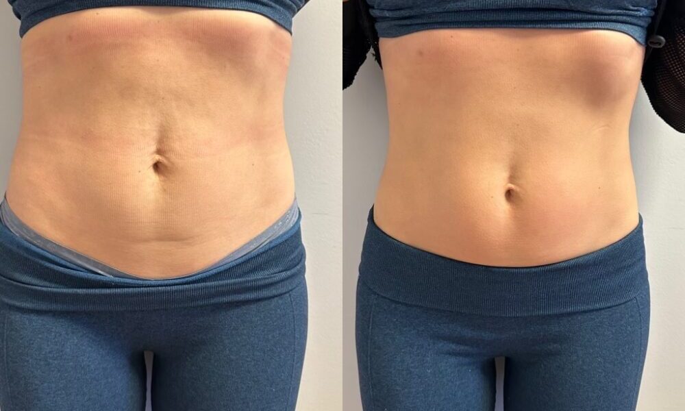 5B3C4E00-5E82-406D-B814-0167187C71E7