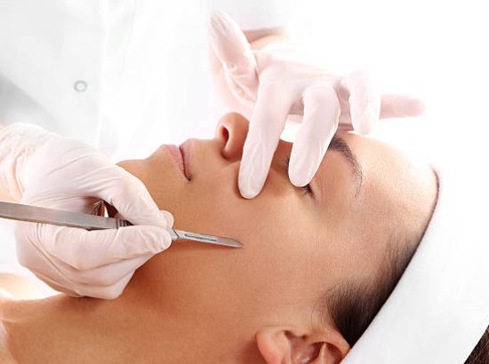 Aesthetician performing dermaplaning facial to exfoliate dead skin cells Close-up of dermaplaning treatment removing peach fuzz and surface debris